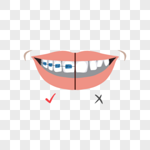 牙套矫正牙齿效果对比图片