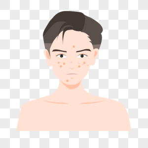 敷面膜流程图美容护肤满脸痘痘的男生图片