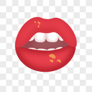 口腔溃疡医用嘴部红嘴唇图片