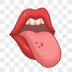 口腔溃疡红色嘴唇舌头溃烂图片