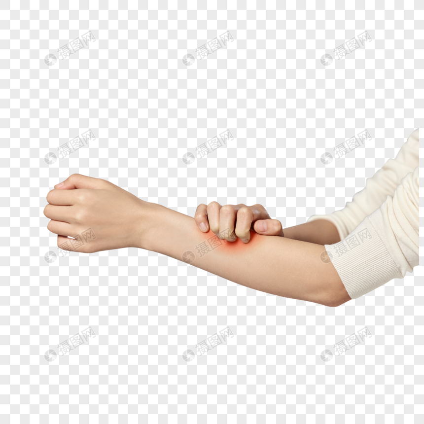 手臂过敏瘙痒抓挠的女性特写图片