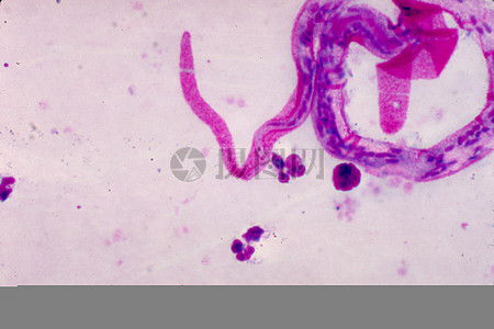 马来微丝蚴镜下图图片