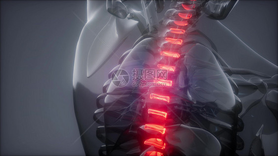 脊骨背痛人体脊柱骨骼发光的科学解剖扫描背部骨头背痛图片