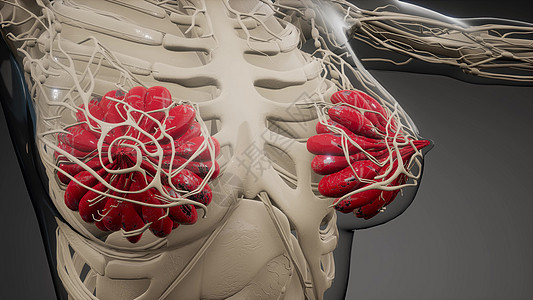 三维医学上准确地说明了个肥胖的妇女乳腺医学上准确的说明肥胖妇女的乳腺图片