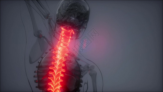 脊骨背痛人体脊柱骨骼发光的科学解剖扫描背部骨头背痛图片