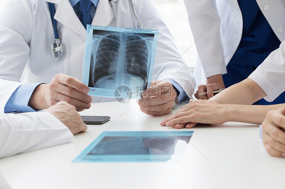 群医生诊所或医院里看并讨论X光群医生讨论X光图片