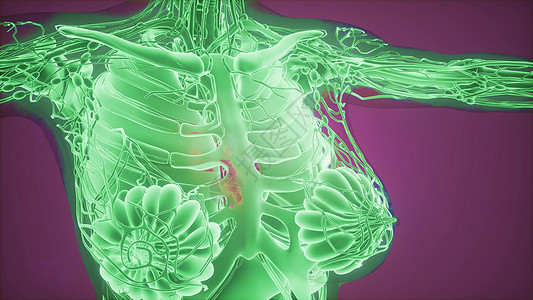 乳腺X线摄影无线电成像用于乳腺癌诊断图片