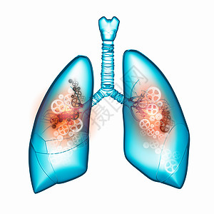 人类的肺用齿轮机构说明人类肺图片