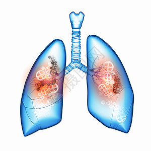 人类的肺机制的人肺健康医学图片