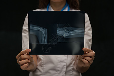 医生检查手臂骨骼X线摄影图片