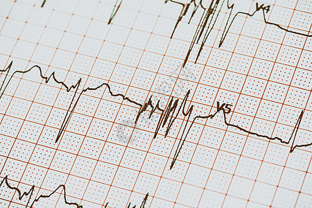 医疗保健心电图上的挤出物背景