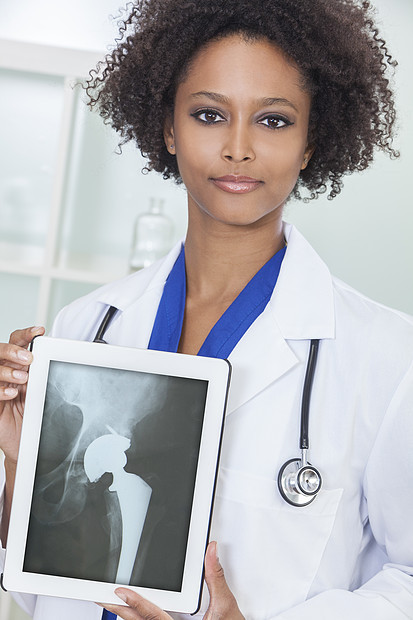 位非裔美国女医生医院里着台平板电脑,屏幕上位髋关节置换病人x光图片