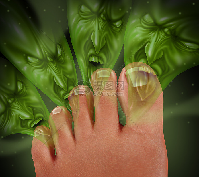 脚臭臭脚与人类脚趾释放可怕的臭味,因为绿色怪物的气体来自出汗的皮肤,足病医学健康的标志细菌感染图片