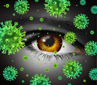 眼睛感染种传染的眼部疾病,感冒流感症状中传播病,传播危险的传染细菌细菌图片