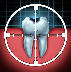 将蛀牙牙齿空洞的封闭符号,并以目标图标为目标,将口腔疾病骨解剖的保健,治疗牙科治疗细菌酸引的腐烂腐烂的方图片