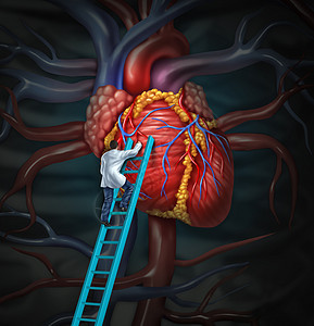 心脏医生治疗保健医疗理念,外科医生心脏病专家爬上梯子,监测检查人体心血管解剖,以便进行医院诊断治疗图片
