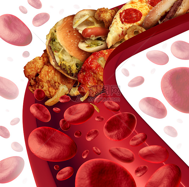 胆固醇阻断了动脉的医学,人体血管被健康的食物堵塞,如汉堡包油炸食品,健康风险的隐喻,节食营养问题如饮食脂肪图片