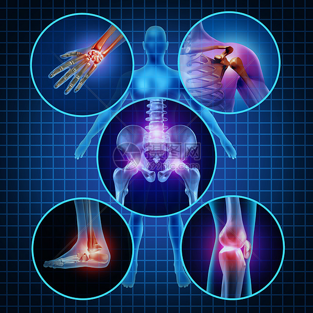 疼痛关节人体解剖,身体圆形板的疼痛区域,疼痛伤害关节炎疾病的象征,医疗保健医疗症状,由于衰老运动工伤图片