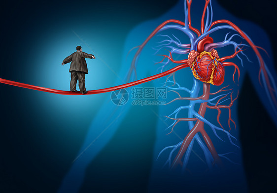 心脏病危险的危险因素种医疗保健生活方式的,超重的人走拉长的动脉高线上,冠心病危险高血压的象征图片