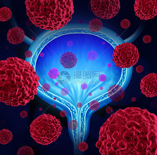 癌恶细胞人体内扩散保健三维插图