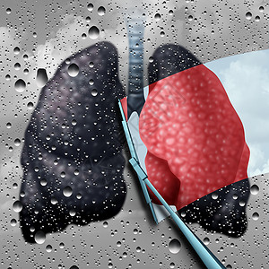 肺健康治疗医学个生病的人类心血管器官雨窗上被雨刷擦拭干净的疾病疾病,比喻疾病的肺部解决方案哮喘治疗与三维插图元素图片