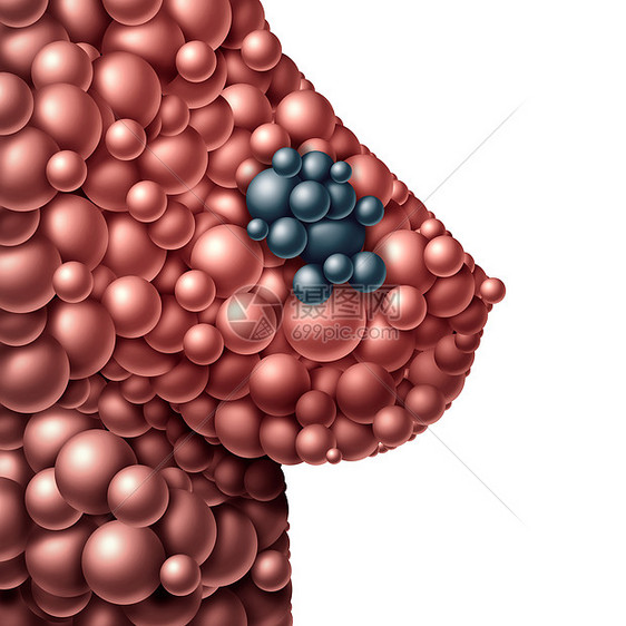 乳腺肿瘤乳腺癌的象征种癌症生长症状诊断的女解剖,由个恶肿块肿块的抽象球体三维插图图片