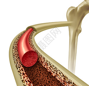 骨髓健康骨质疏松症的,个健康的解剖与强大的正常个图标骨科骨科与三维插图元素背景图片