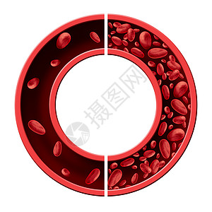 贫血贫血医学图的正常异常的血细胞计数人动脉静脉中的循环,白色背景上分离的三维图图片