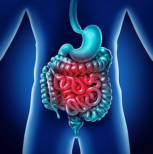 肠痛胃内消化炎症问题消化适便秘感染A3D插图背景图片