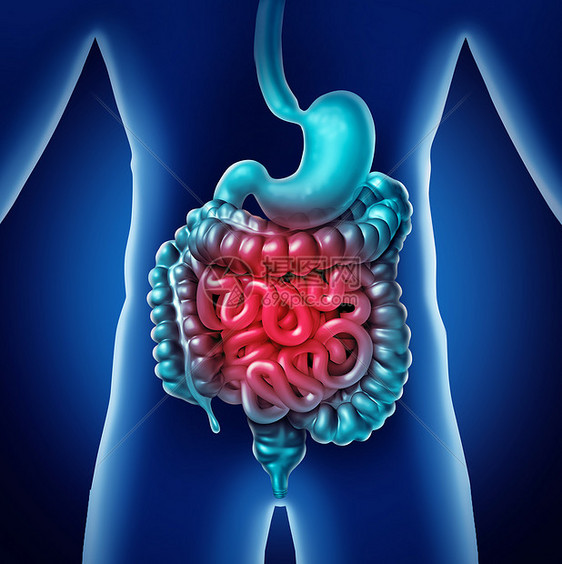 肠痛胃内消化炎症问题消化适便秘感染A3D插图图片
