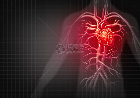 心脏病发作胸痛医学心血管疾病种疾病的人体循环器官三维插图风格图片