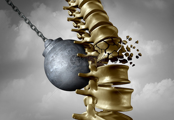 脊柱疼痛脊柱疼痛巴赫奇医疗疾病的象征,个破坏球击中个人的骨骼,个背部医学图标个三维插图图片