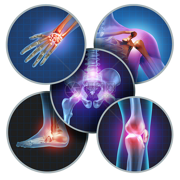 人体疼痛关节的与骨骼解剖的身体与疮与发光的关节疼痛伤害关节炎疾病的象征,保健医疗症状图片