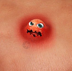粉刺怪物痤疮格人类皮肤科皮肤健康的与三维插图元素图片