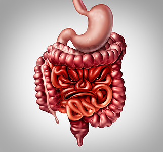 肠易激综合征的诊断症状的肠结肠炎症疼痛,如肠形状为愤怒的脸与三维插图元素背景图片