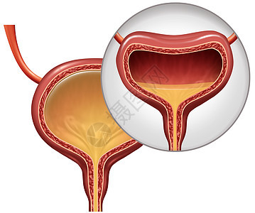 膀胱过度活动自主的排尿个舒服的情况下,个人的器官与三维插图元素背景图片