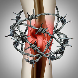 的关节人体骨骼疼痛的医学插图图片