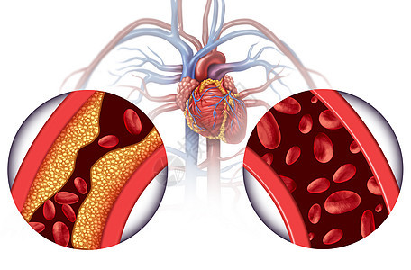 治疗心脏病血液循环疾病背景图片