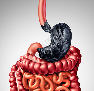 人类消化问题个胃,形状为垃圾袋,肠道器官消化系统消化良疼痛的象征,医学上的例子人类消化问题图片