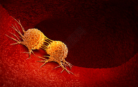 癌细胞分裂治疗由致癌物遗传学引的人体恶癌细胞,以癌细胞为免疫治疗符号,以医学治疗为三维图示背景图片