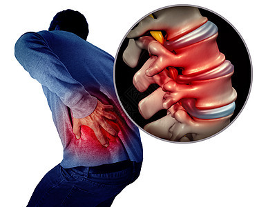 腰痛背痛疼痛脊柱医学个人持疼痛脊柱区域个医学与三维插图元素背景图片