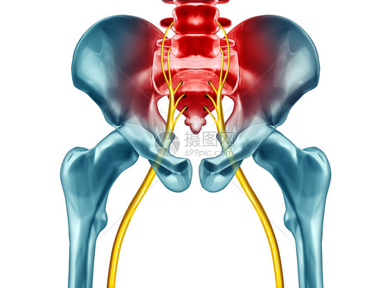 坐骨神经痛症状诊断医学,种疾病,引身体问题的三维插图元素白色背景图片
