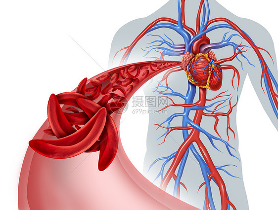 镰状细胞心脏循环阻塞贫血种正常异常血红蛋白的疾病,人体动脉解剖中心脏心血管医学图示的,三维图示元素图片