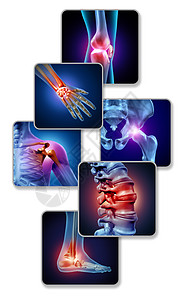 人体关节疼痛骨骼肌肉解剖的身体与疼痛的关节疼痛的伤害关节炎疾病的象征,保健医疗症状与三维插图元素图片