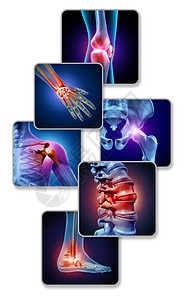 人体关节疼痛骨骼肌肉解剖的身体与疼痛的关节疼痛的伤害关节炎疾病的象征,保健医疗症状与三维插图元素背景图片