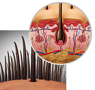 毛囊解剖图Dermitology医学人的头发与头皮出现三维插图图片