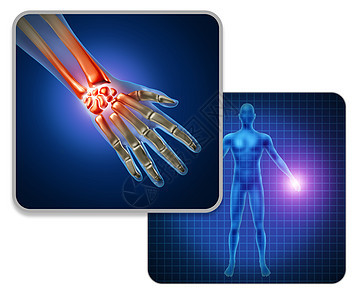 人手关节疼痛为骨骼肌肉解剖的身体与疼痛的手腕手指关节疼痛的伤害关节炎的疾病符号与三维插图元素背景图片