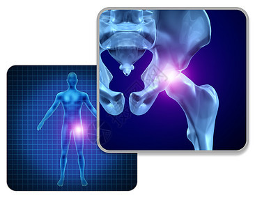 人髋关节疼痛骨骼肌肉解剖的身体与疼痛的关节疼痛的伤害关节炎疾病的象征,保健医疗症状与三维插图元素图片