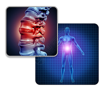 人背部关节疼痛的骨骼肌肉解剖的身体与疼痛的脊柱关节疼痛的巴赫伤害关节炎疾病的象征与三维插图元素背景图片