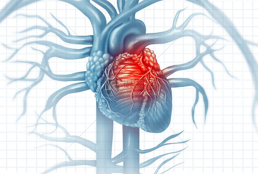 心血管疾病人类心脏病发作疼痛种解剖医学疾病的,个人患心脏病个痛苦的冠状动脉事件与三维插图风格的元素图片